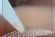 小米11u背胶的正确贴法是什么？