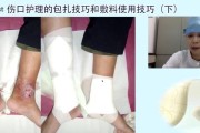 老人跑步机摔伤了怎么修（老年人安全使用跑步机的重要性与修理注意事项）