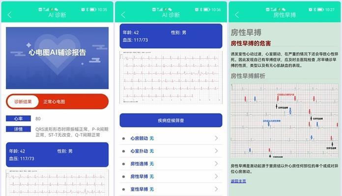 智能手表测血压线的使用方法和准确性？